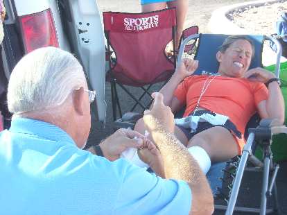 John the foot doctor injecting zinc oxide to help dry a blister on the underside of Alene's left foot.