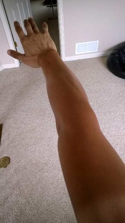 Felix Wong's arm, extreme tan lines, 2015 Trans Am Bike Race