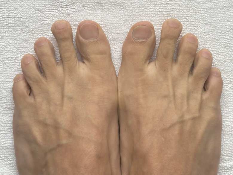 clean feet with no blackened toenails